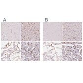 Anti-MRC1 antibody produced in rabbit Prestige Antibodies® Powered by Atlas Antibodies, affinity isolated antibody, buffered aqueous glycerol solution
