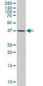 Monoclonal Anti-CDX2 antibody produced in mouse clone 1C7, purified immunoglobulin, buffered aqueous solution