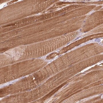 Anti-FAM65C antibody produced in rabbit Prestige Antibodies&#174; Powered by Atlas Antibodies, affinity isolated antibody, buffered aqueous glycerol solution