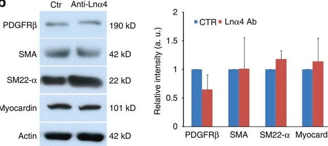 Anti-Actin, &#945;-Smooth Muscle - FITC antibody, Mouse monoclonal clone 1A4, purified from hybridoma cell culture