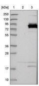 Anti-CCDC170 antibody produced in rabbit Prestige Antibodies&#174; Powered by Atlas Antibodies, affinity isolated antibody, buffered aqueous glycerol solution