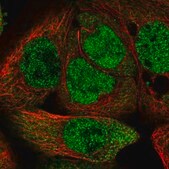 Anti-TRIM56 antibody produced in rabbit Prestige Antibodies&#174; Powered by Atlas Antibodies, affinity isolated antibody, buffered aqueous glycerol solution