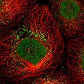Anti-UPP2 antibody produced in rabbit Prestige Antibodies® Powered by Atlas Antibodies, affinity isolated antibody, buffered aqueous glycerol solution