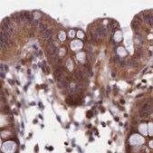 抗-NUBP1 兔抗 Prestige Antibodies&#174; Powered by Atlas Antibodies, affinity isolated antibody, buffered aqueous glycerol solution