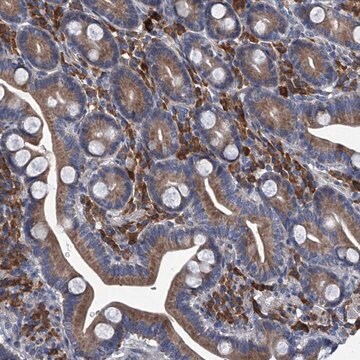 Anti-ABCG1 antibody produced in rabbit Prestige Antibodies&#174; Powered by Atlas Antibodies, affinity isolated antibody, buffered aqueous glycerol solution, ab2