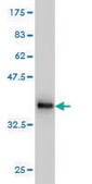 Monoclonal Anti-NADSYN1 antibody produced in mouse clone 4G9, purified immunoglobulin, buffered aqueous solution