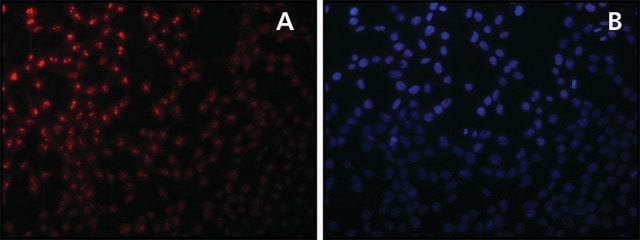 Anti-Sirt7 兔抗 affinity isolated antibody, buffered aqueous solution