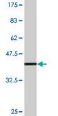 Monoclonal Anti-SC65 antibody produced in mouse clone 1E12, purified immunoglobulin, buffered aqueous solution