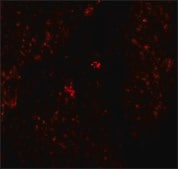 Anti-HMMR antibody produced in rabbit affinity isolated antibody