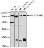 Anti-WAVE2/WASF2 Antibody, clone 7A6C10, Rabbit Monoclonal