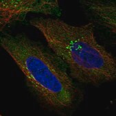 Anti-NOD2 antibody produced in rabbit Prestige Antibodies® Powered by Atlas Antibodies, affinity isolated antibody