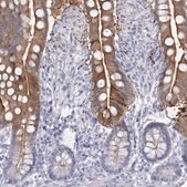 Anti-SLC6A19 antibody produced in rabbit Prestige Antibodies&#174; Powered by Atlas Antibodies, affinity isolated antibody, buffered aqueous glycerol solution