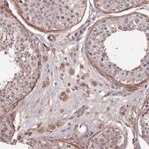 Anti-NLRC4 antibody produced in rabbit Prestige Antibodies&#174; Powered by Atlas Antibodies, affinity isolated antibody, buffered aqueous glycerol solution