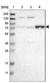 Anti-ENTPD4 antibody produced in rabbit Prestige Antibodies&#174; Powered by Atlas Antibodies, affinity isolated antibody, buffered aqueous glycerol solution