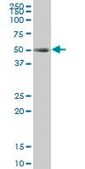 Monoclonal Anti-TCF2 antibody produced in mouse clone 3E11, purified immunoglobulin, buffered aqueous solution