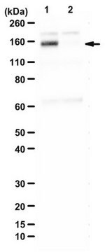 Anti-DNA helicase B (HELB) from rabbit