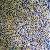 Anti-phospho-B-RAF (pThr599) antibody produced in rabbit affinity isolated antibody