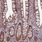 Anti-RCCD1 antibody produced in rabbit Prestige Antibodies&#174; Powered by Atlas Antibodies, affinity isolated antibody, buffered aqueous glycerol solution