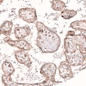 Monoclonal Anti-ROR2 antibody produced in mouse Prestige Antibodies&#174; Powered by Atlas Antibodies, clone CL5950, purified immunoglobulin, buffered aqueous glycerol solution