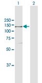 Anti-IARS antibody produced in rabbit purified immunoglobulin, buffered aqueous solution