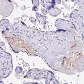 Anti-TAC3 antibody produced in rabbit Prestige Antibodies&#174; Powered by Atlas Antibodies, affinity isolated antibody, buffered aqueous glycerol solution