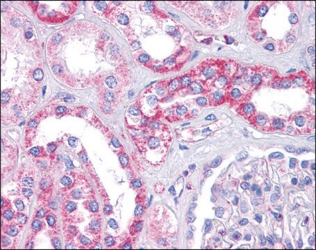 Anti-SIPA1L1 antibody produced in rabbit affinity isolated antibody