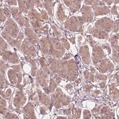 Anti-SSU72 antibody produced in rabbit Prestige Antibodies&#174; Powered by Atlas Antibodies, affinity isolated antibody, buffered aqueous glycerol solution