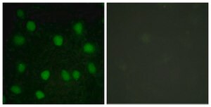 Anti-Dematin antibody produced in rabbit affinity isolated antibody