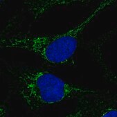 Anti-CMC4 antibody produced in rabbit Prestige Antibodies® Powered by Atlas Antibodies, affinity isolated antibody, buffered aqueous glycerol solution