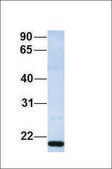 Anti-ZNF428 antibody produced in rabbit affinity isolated antibody