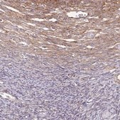 Anti-EEF2 antibody produced in rabbit Prestige Antibodies&#174; Powered by Atlas Antibodies, affinity isolated antibody