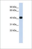 Anti-TRIOBP antibody produced in rabbit affinity isolated antibody