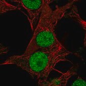 Anti-DHRS12 antibody produced in rabbit Prestige Antibodies® Powered by Atlas Antibodies, affinity isolated antibody, buffered aqueous glycerol solution
