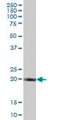 Anti-RBED1 antibody produced in mouse IgG fraction of antiserum, buffered aqueous solution