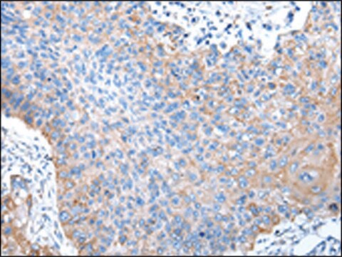 Anti-PTGIR affinity isolated antibody