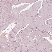 Anti-RS1 antibody produced in rabbit Prestige Antibodies&#174; Powered by Atlas Antibodies, affinity isolated antibody