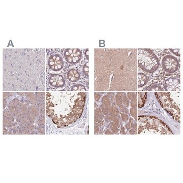 Anti-STIP1 antibody produced in rabbit Prestige Antibodies&#174; Powered by Atlas Antibodies, affinity isolated antibody, buffered aqueous glycerol solution