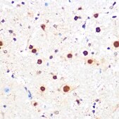 Anti-KLF4 antibody produced in rabbit