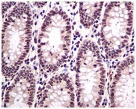 Anti-HMGN2, clone EPR7091, Rabbit Monoclonal Antibody clone EPR7091, from rabbit