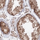 Anti-KIF20A antibody produced in rabbit Prestige Antibodies&#174; Powered by Atlas Antibodies, affinity isolated antibody, buffered aqueous glycerol solution