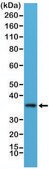 Anti-MYD88 antibody, Rabbit Monoclonal recombinant, expressed in HEK 293 cells, clone RM306, purified immunoglobulin