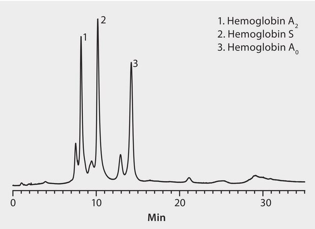 HPLC Analysis of Hemoglobin Variants on Discovery® BIO PolyMA-WAX application for HPLC