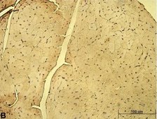 Anti-CD46 antibody produced in rabbit Prestige Antibodies® Powered by Atlas Antibodies, affinity isolated antibody, buffered aqueous glycerol solution
