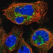 Anti-KIAA0430 antibody produced in rabbit Prestige Antibodies&#174; Powered by Atlas Antibodies, affinity isolated antibody, buffered aqueous glycerol solution