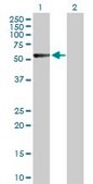 Anti-CALCR antibody produced in rabbit purified immunoglobulin, buffered aqueous solution