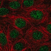 Anti-NR4A1 antibody produced in rabbit Prestige Antibodies&#174; Powered by Atlas Antibodies, affinity isolated antibody