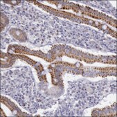 Anti-FRMD6 antibody produced in rabbit Prestige Antibodies® Powered by Atlas Antibodies, affinity isolated antibody, buffered aqueous glycerol solution