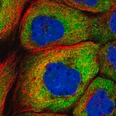 Anti-YBX3 antibody produced in rabbit Prestige Antibodies&#174; Powered by Atlas Antibodies, affinity isolated antibody, buffered aqueous glycerol solution