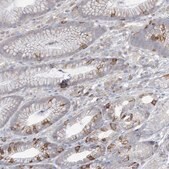 Anti-AOC1 antibody produced in rabbit Prestige Antibodies&#174; Powered by Atlas Antibodies, affinity isolated antibody, buffered aqueous glycerol solution