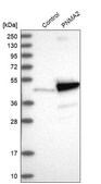 Anti-PNMA2 antibody produced in rabbit Prestige Antibodies® Powered by Atlas Antibodies, affinity isolated antibody, buffered aqueous glycerol solution